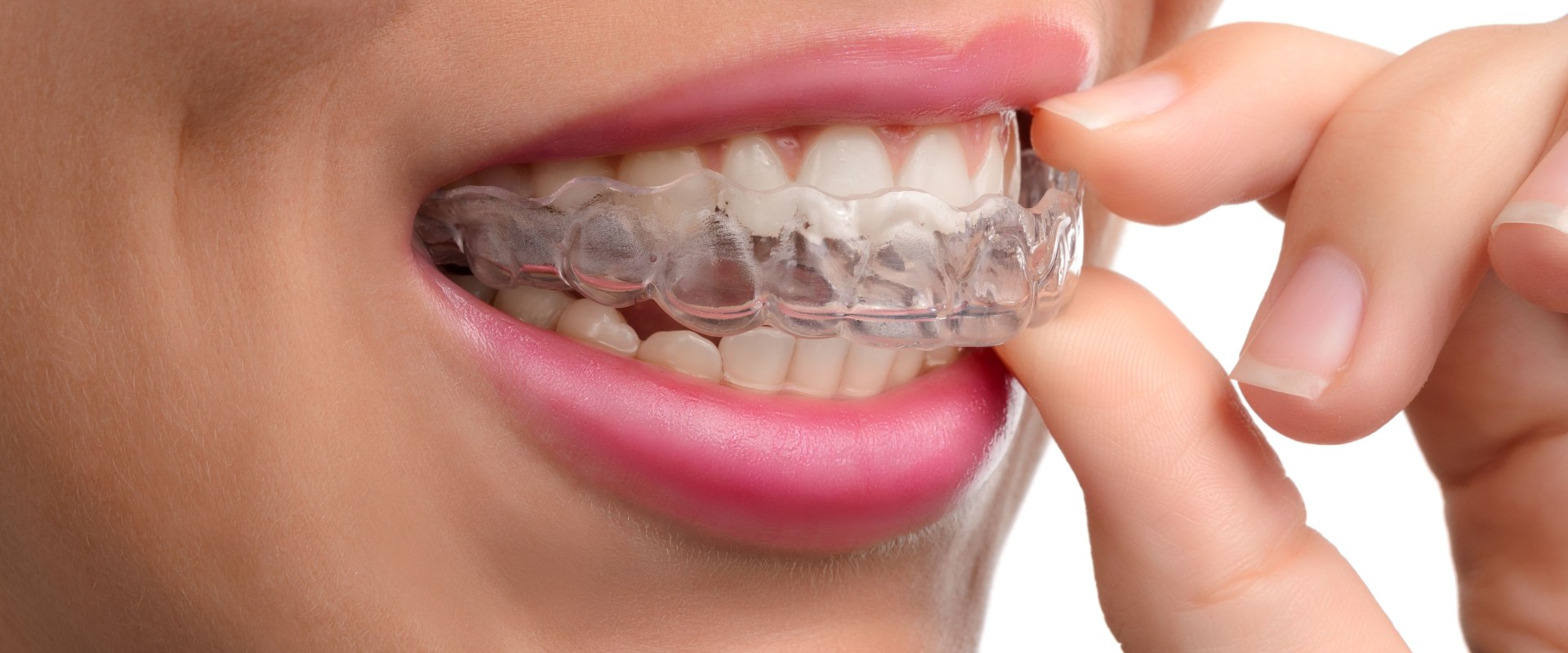 Why Does Invisalign Hurt? Expert Tips to Ease