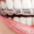 Can Invisalign Retainers Be Adjusted?