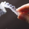 The Benefits of Invisalign Cleaning Crystals
