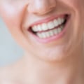 What to do When Your Invisalign Retainer Doesn't Fit