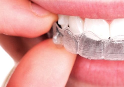 Can You Use Invisalign Cleaning Crystals More Than Once?