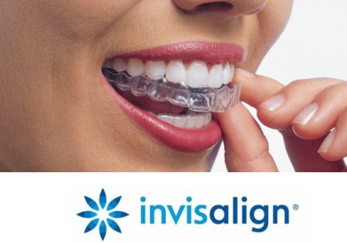 Invisalign Dentist