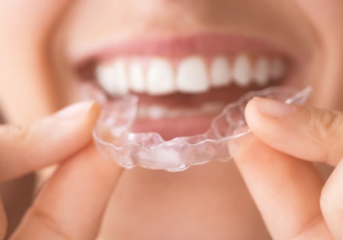 SmileDirectClub vs Invisalign: Which is the Best Option for Teeth Alignment?